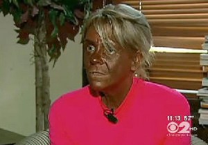 Kako danas izgleda najpoznatija zavisnica od solarijuma Patrisija Krentsil