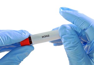 Ove godine sezona gripa počela je 4 nedelje ranije