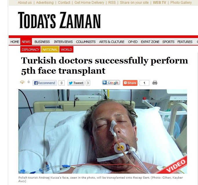 Twarz polskiego turysty przeszczpiono 27-letniemu Turkowi, fot. screen z Today's Zaman