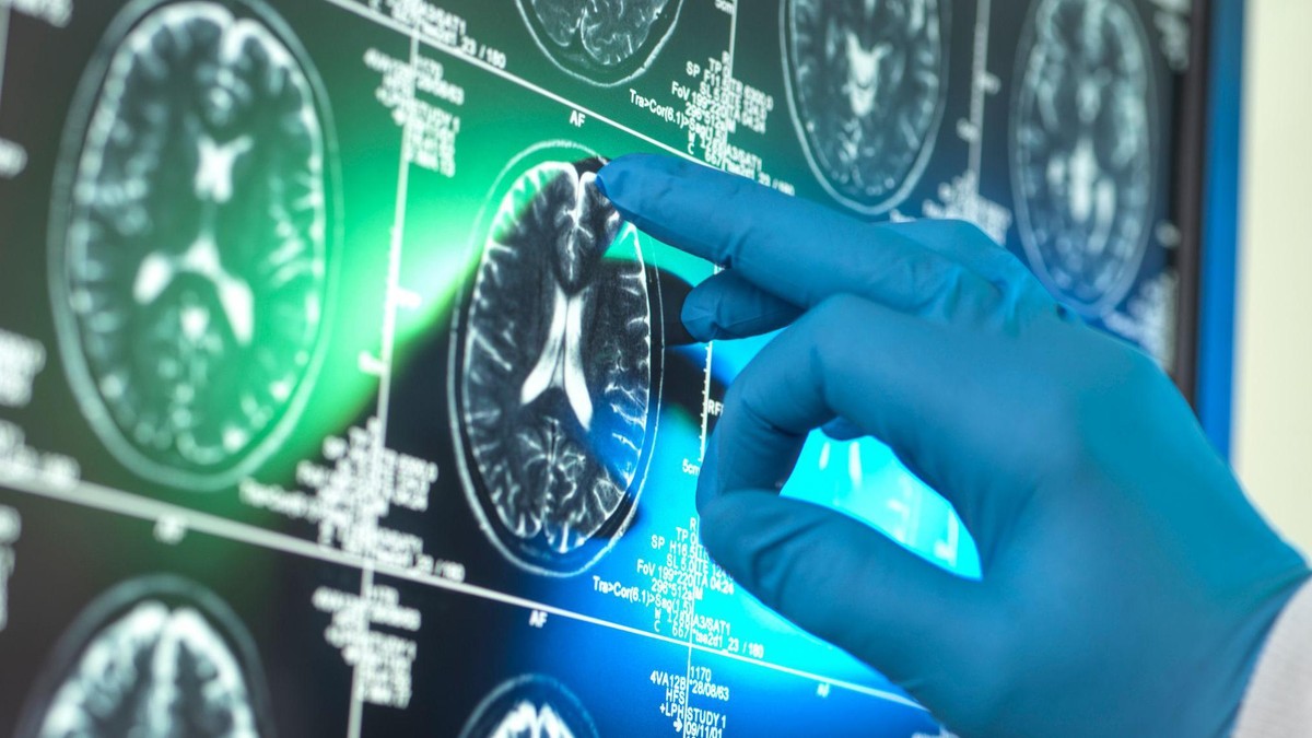 BBC | Foto: Getty Images