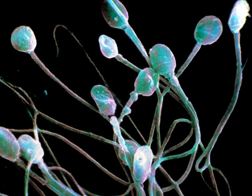 Sperma