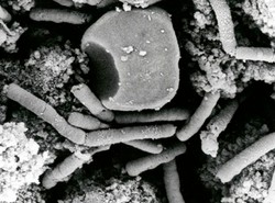 Nowa superbakteria jest już w Europie