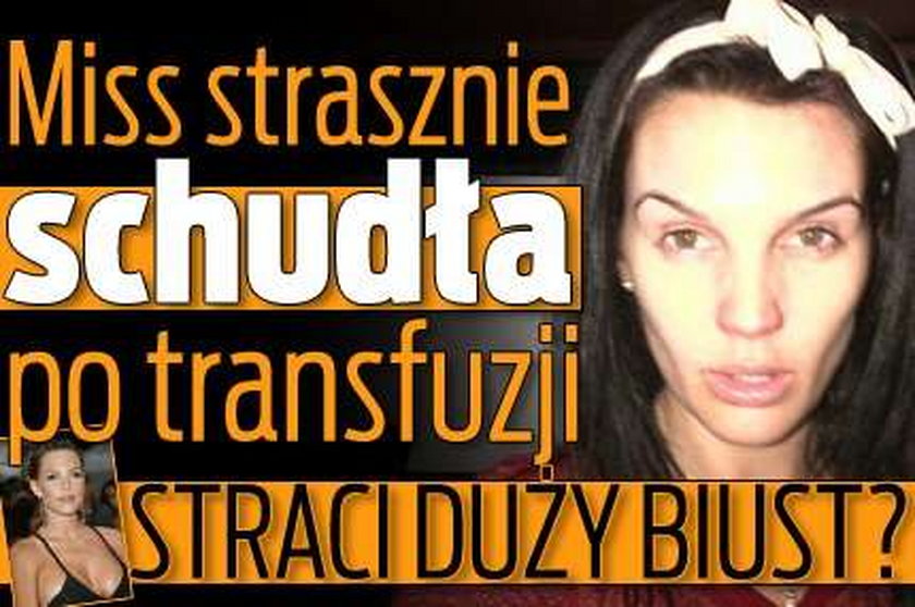 Celebrytka straci duży biust? Strasznie schudła po transfuzji