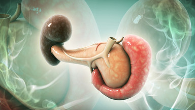 Rak trzustki to jeden z najgroźniejszych nowotworów. Liczba chorych Polaków rośnie