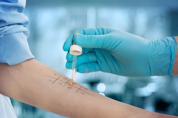 Hogyan értelmezzem az allergiavizsgálatom eredményét? Az orvos válaszol