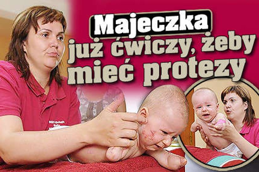 Majeczka już ćwiczy, żeby mieć protezy