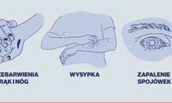 Objawy COVID-19 - typowe i nietypowe [INFOGRAFIKA]