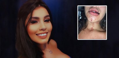 19-letnia celebrytka odurzona i brutalnie skrzywdzona przez grono influencerów. Chce sprawiedliwości