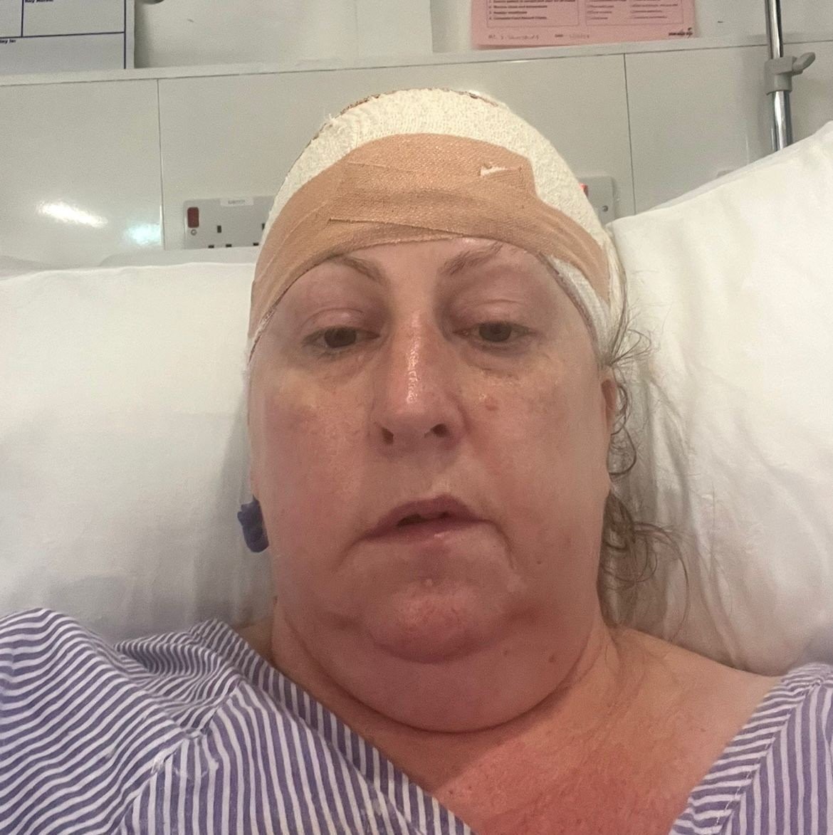 Lekári Tracy našli nádor za pravým uchom.