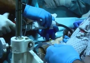 cTIF procedura za trajno lečenje gorušice