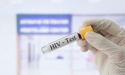 Badanie na HIV - po jakim czasie je wykonać? Badania HIV w ciąży