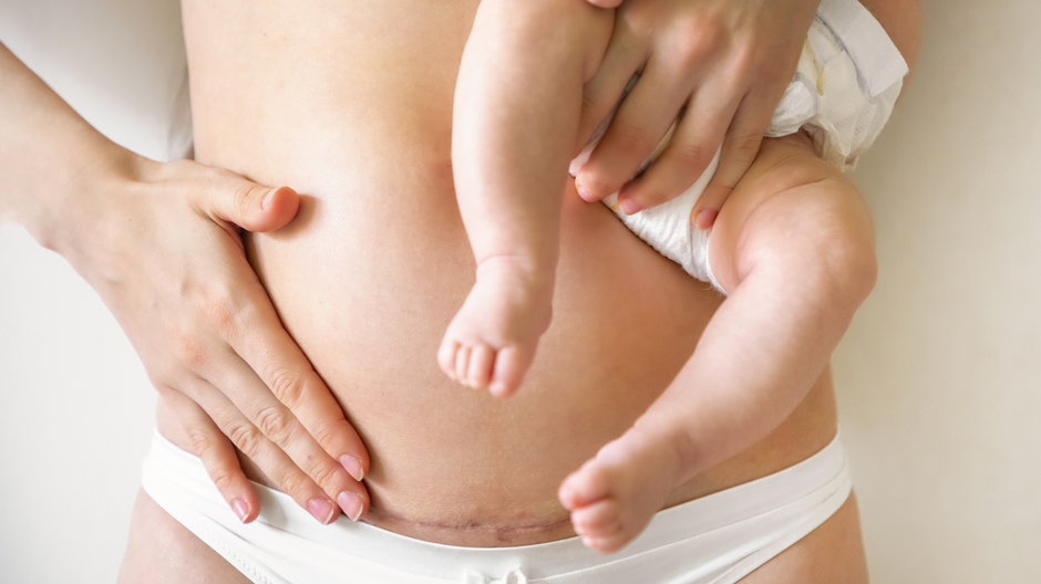 Brzuch po porodzie - jak się zmienia?