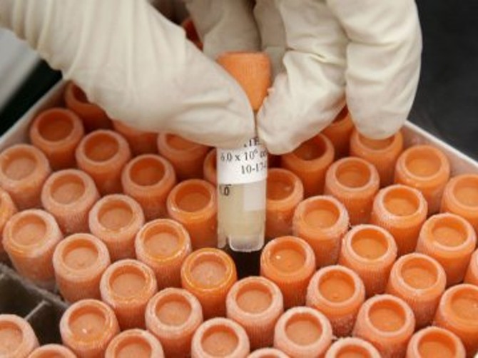 14182_maticne celije