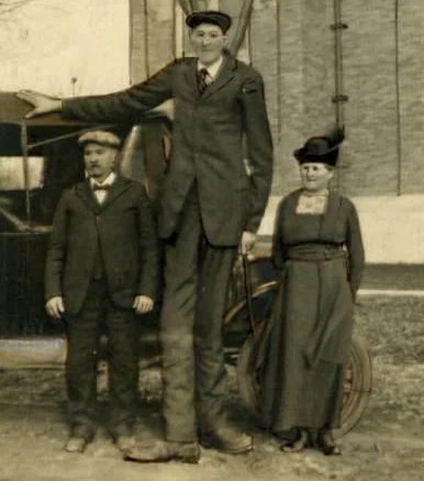 Bernard Coyne był najwyższym człowiekiem na świecie, o ciągle zwiększającym się wzroście. Mierzył 2,54 cm w chwili swojej śmierci w 1921 r. W Księdze Rekordów Guinnessa stwierdzono, że z tego powodu odmówiono mu powołania do armii. Został pochowany w Anthon w USA w specjalnie wykonanej, bardzo dużej trumnie
