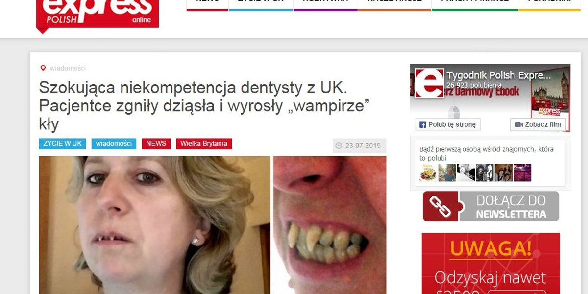 Dentysta-sadysta zrobił z niej wampirzycę!