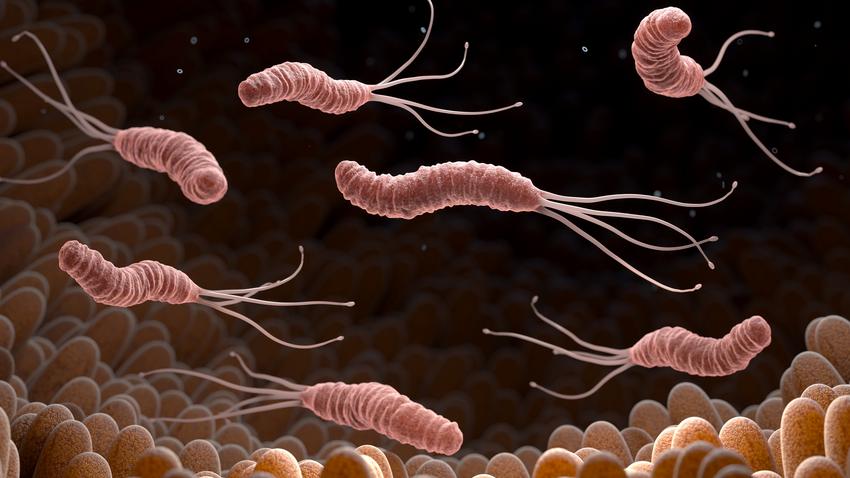 fertőző baktérium Helicobacter pylori fekély gyomor rák sok sav