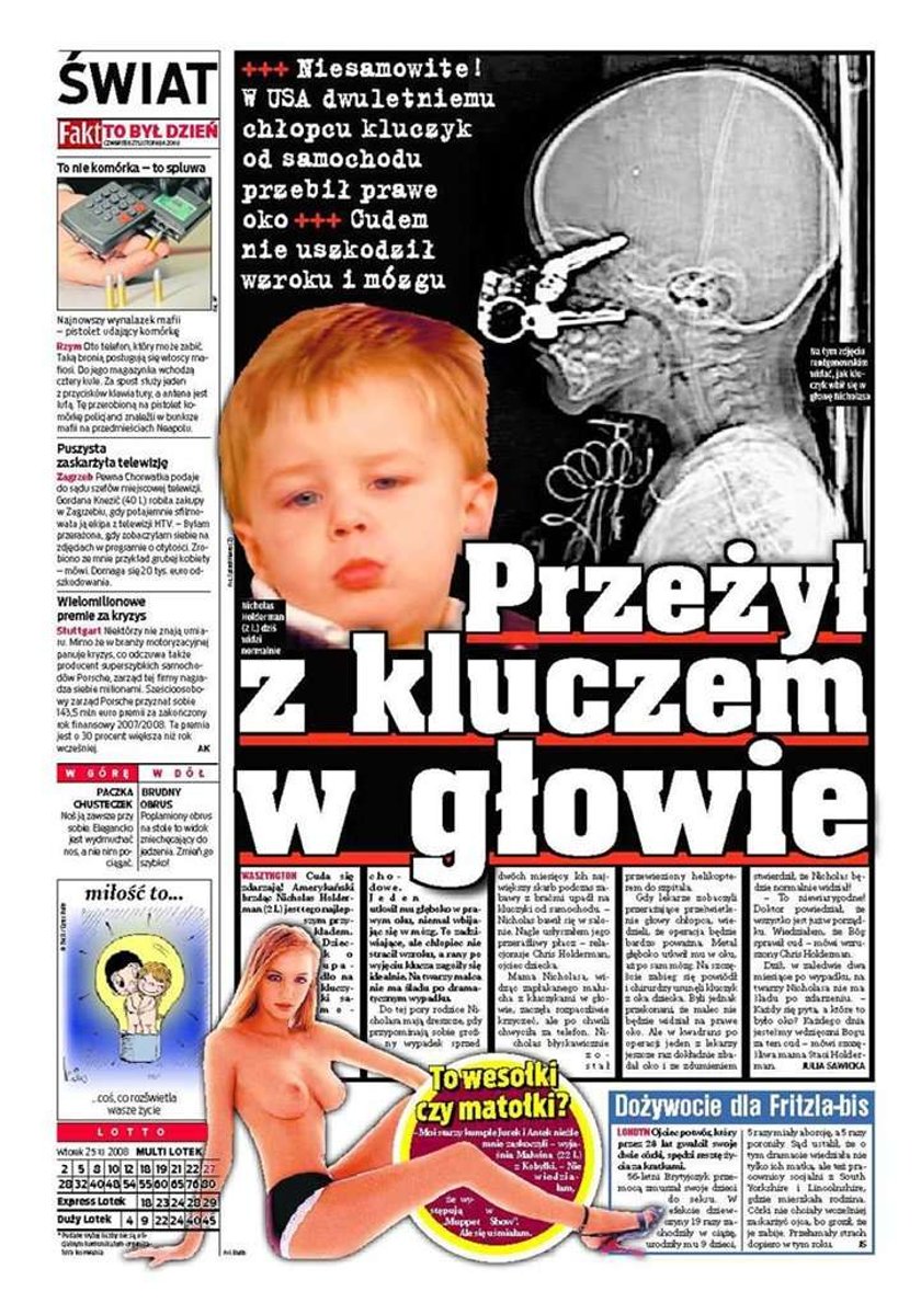 Przeżył z kluczem w głowie