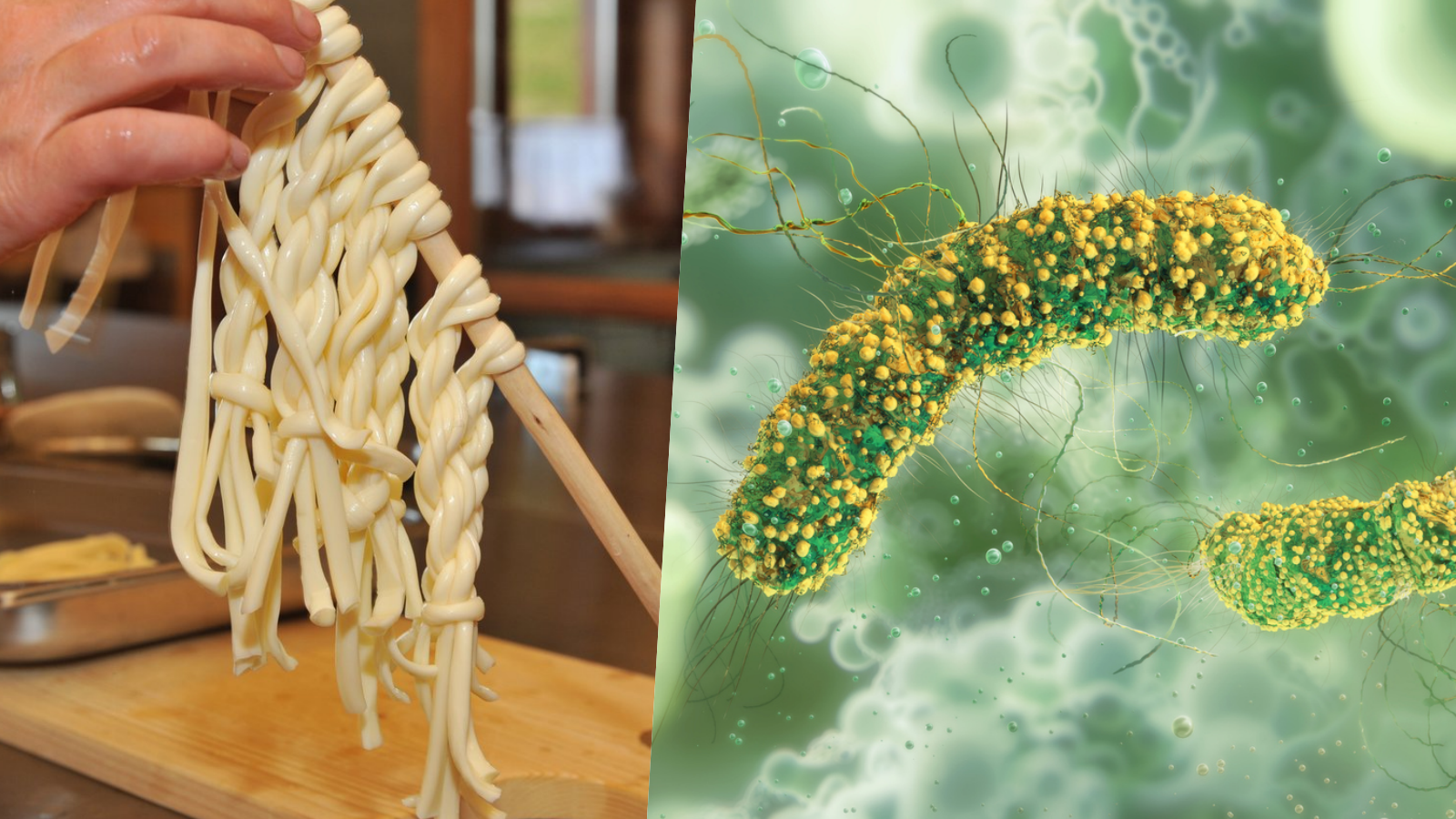 Žena sa po konzumácii syra nakazila baktériou Listeria monocytogenes.