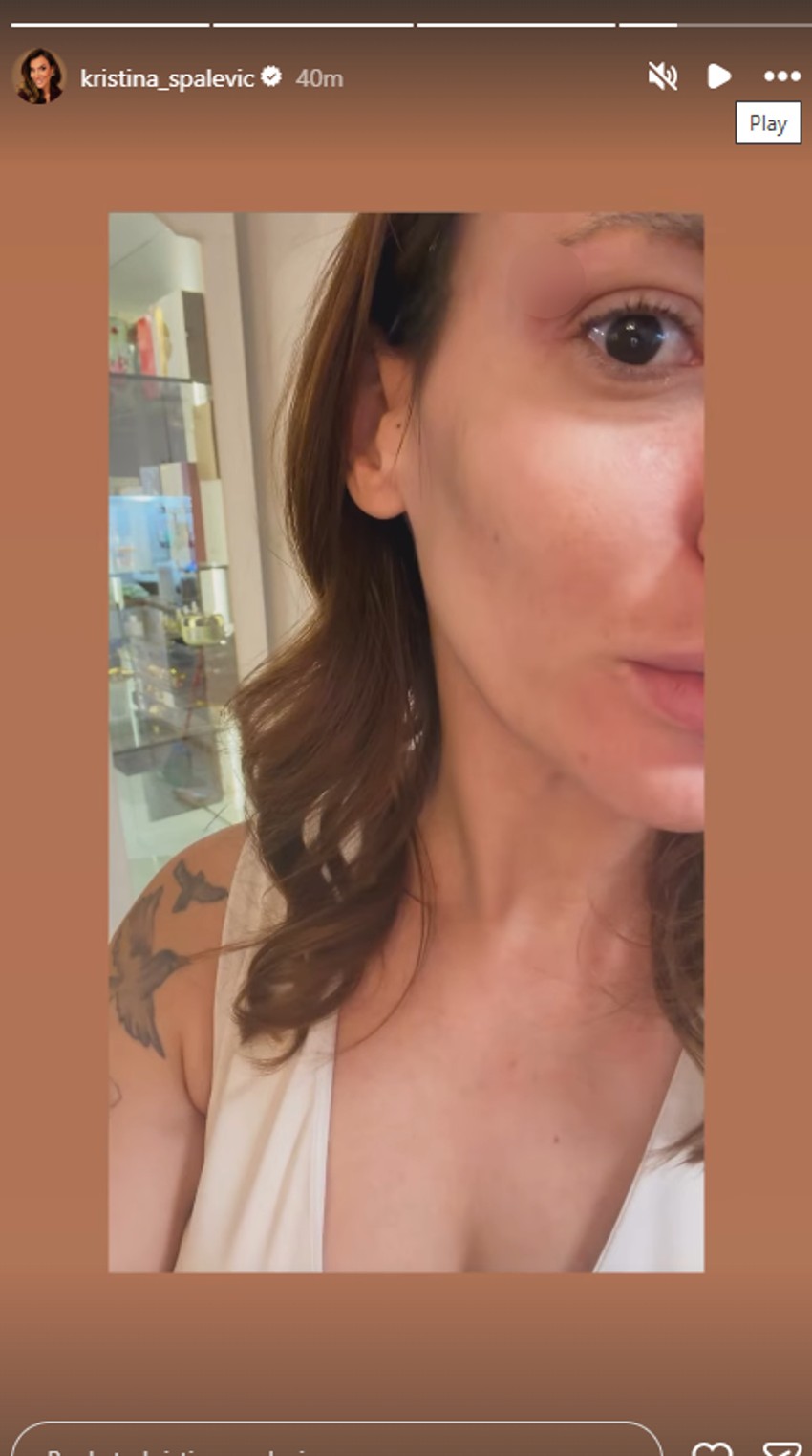 Kristina Spalević se oglasila i pokazala modricu: "Razvalio mi je arkadu"