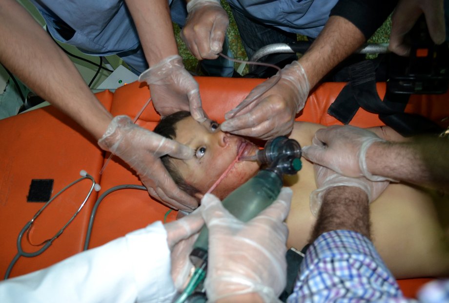 A boy affected by what activists say was a gas attack on the town of Telminnes receives treatment in Bab al-Hawa hospital, where he was transferred, close to the Turkish border, April 21, 2014.