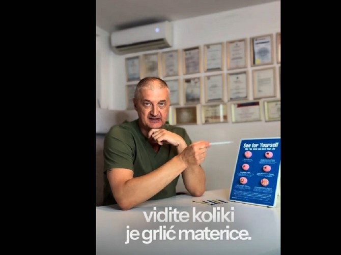 Ginekolog Igor Jeremić objašnjava zašto ne veruje u papa test, pa navodi primere iz prakse