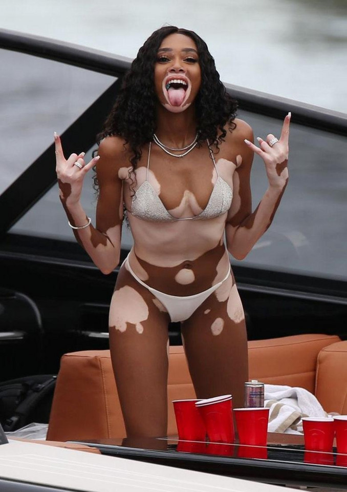 Winnie Harlow