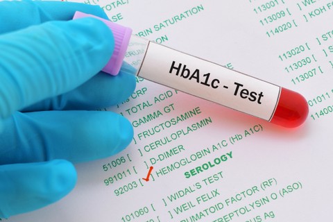 Mit jelent a HbA1c érték a laborleleten?