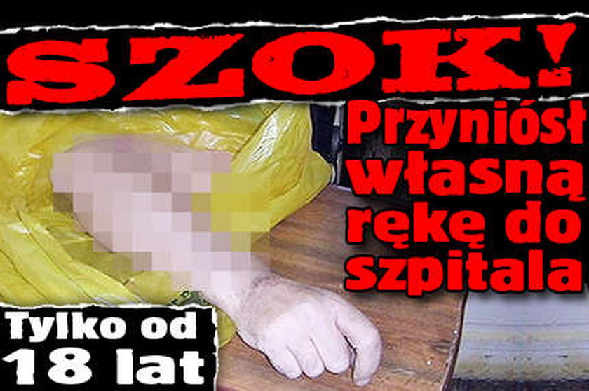 Szok! Przyniósł własną rękę do szpitala