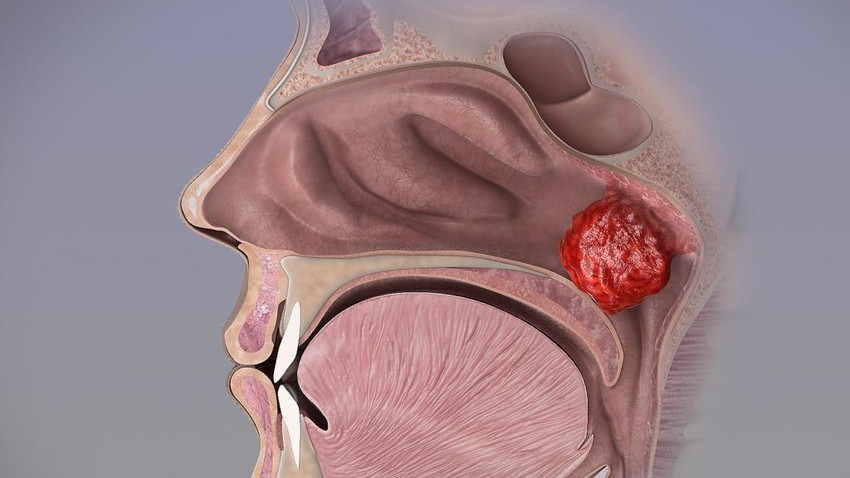 a rhinitis fertőző tünetei)