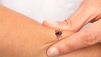 Így tette tönkre a Lyme-kór a fiatal nő életét – nem vette komolyan a lábán megjelenő piros foltot című cikk nyitóképe