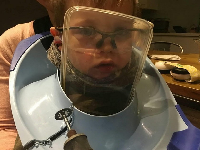 Anglia: Deska sedesowa utknęła mu na głowie. Dziecku pomogli strażacy
