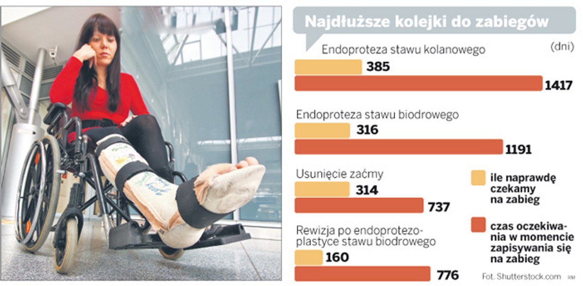 Najdłuższe kolejki do zabiegów