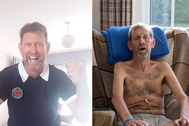 Lekari su mislili da je PIJAN i potpuno zanemarili da OVI SIMPTOMI ukazuju na TEŠKU BOLEST: Kad su ga poslali kod neurologa VEĆ JE BILO KASNO i sad su mu dani odbrojani