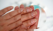 Objawy chorej tarczycy widać na paznokciach. Zwróć uwagę na te znaki