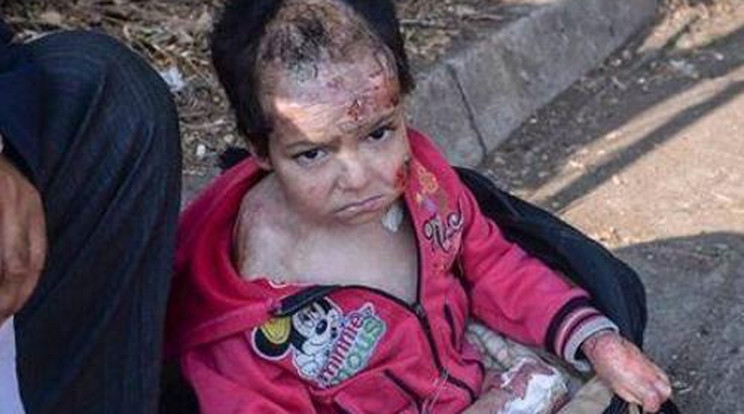 Mégsem a sokak által keresett szír kisfiút ápolják a pesti kórházban