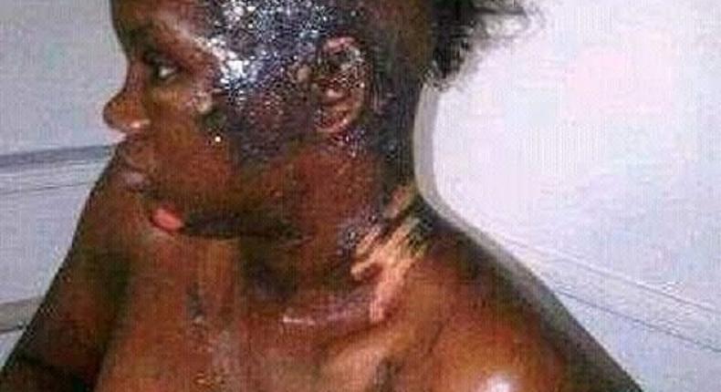 This poor girl has been disfigured by a jealous wife
