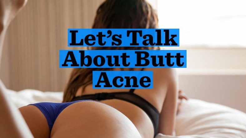 Acne Ass Sex - Health Tips 4 ways to get rid of butt acne - Pulse Ghana