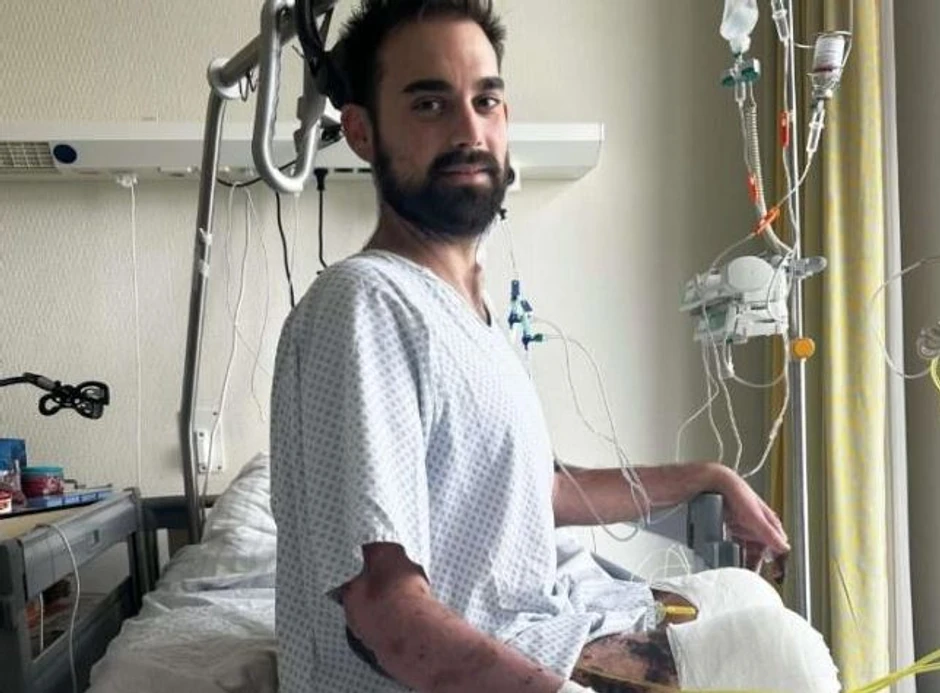 Ostao bez ruku i nogu