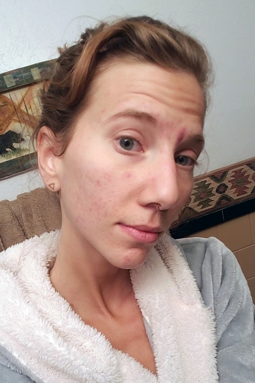 Džulija Silaman redovno pije urin i utrljava ga u kožu