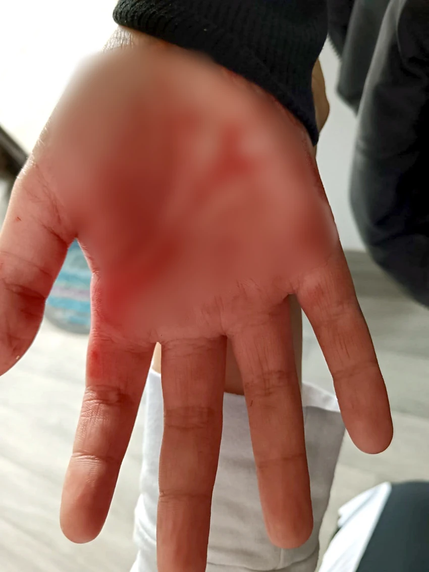 В.С., ученик од Власотицин, врсничко насилство