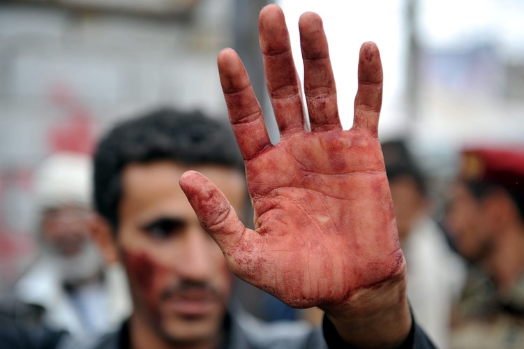 Jemeńczyk pokazuje zakrwawione ręce po tym jak przenosił postrzelonych demonstrantów, Sana, Jemen, 24 listopada 2011