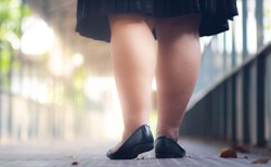 Lipoedema - choroba grubych nóg. Jak sobie z tym poradzić?