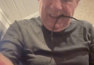 Čovek sam sebi izvadio zub