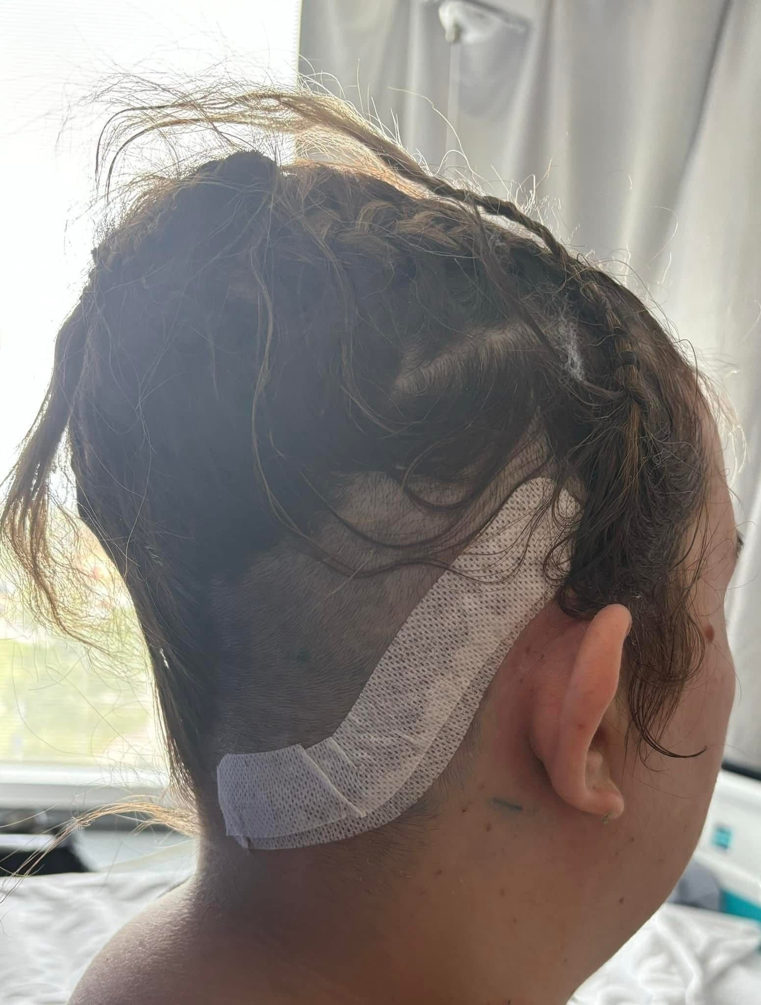 Amy diagnostikovali nádor na mozgu.