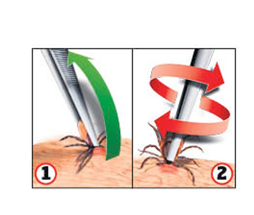 Tak bezpiecznie usuniesz kleszcza