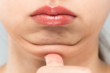 Mitől alakul ki a toka? Így lehet újra szép a nyakkontúrja