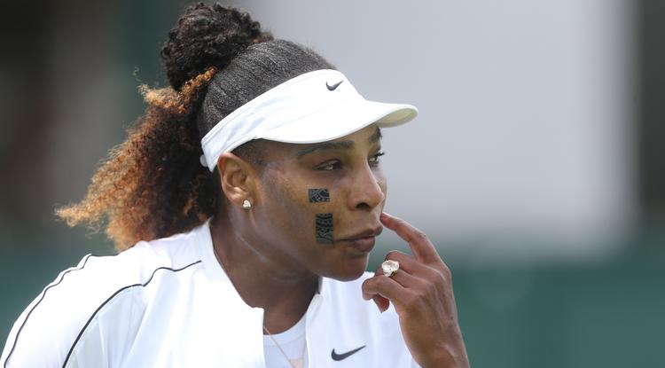 Serena Williams furcsa tapaszokkal az arcán játszik Wimbledonban, elárulta miért