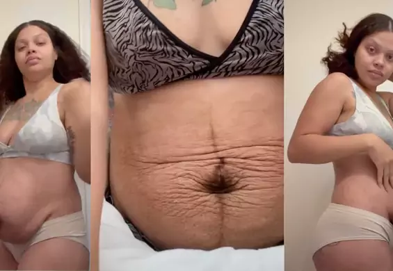 Pokazała, jak wygląda jej brzuch po czterech porodach