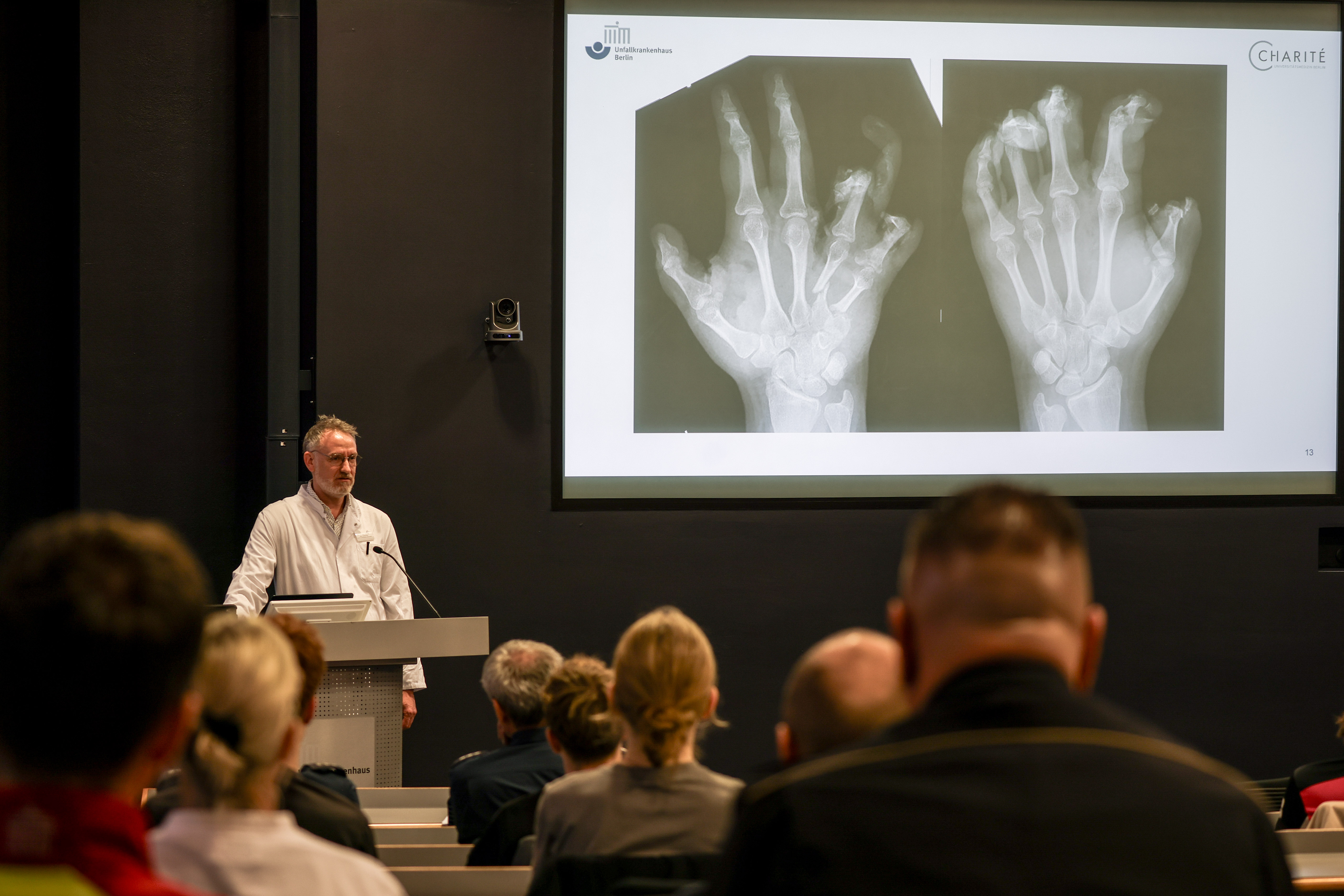 Silvester-Prognose: Berliner Klinik erwartet bis zu 40 Böller-Operationen