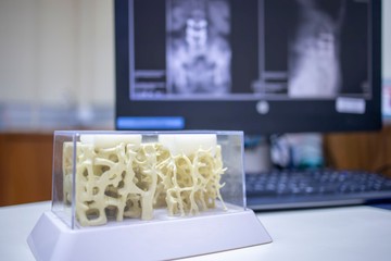 Ezért gyengülnek el a csontjaink! Nem kell beletörődni: így erősítheti meg akár 50 felett is